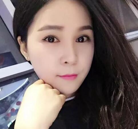 祛斑方法分享:43岁妇女变少女